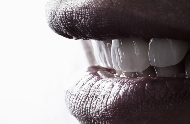 Close-up of lips and veneers